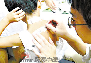 灸法的種類  你知道多少？